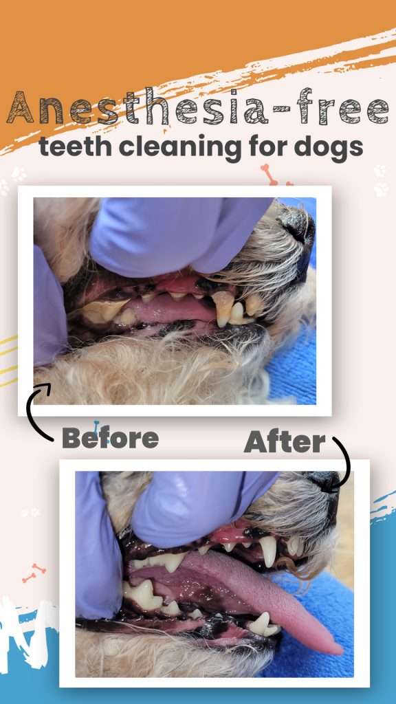 before&after teeth cleaning